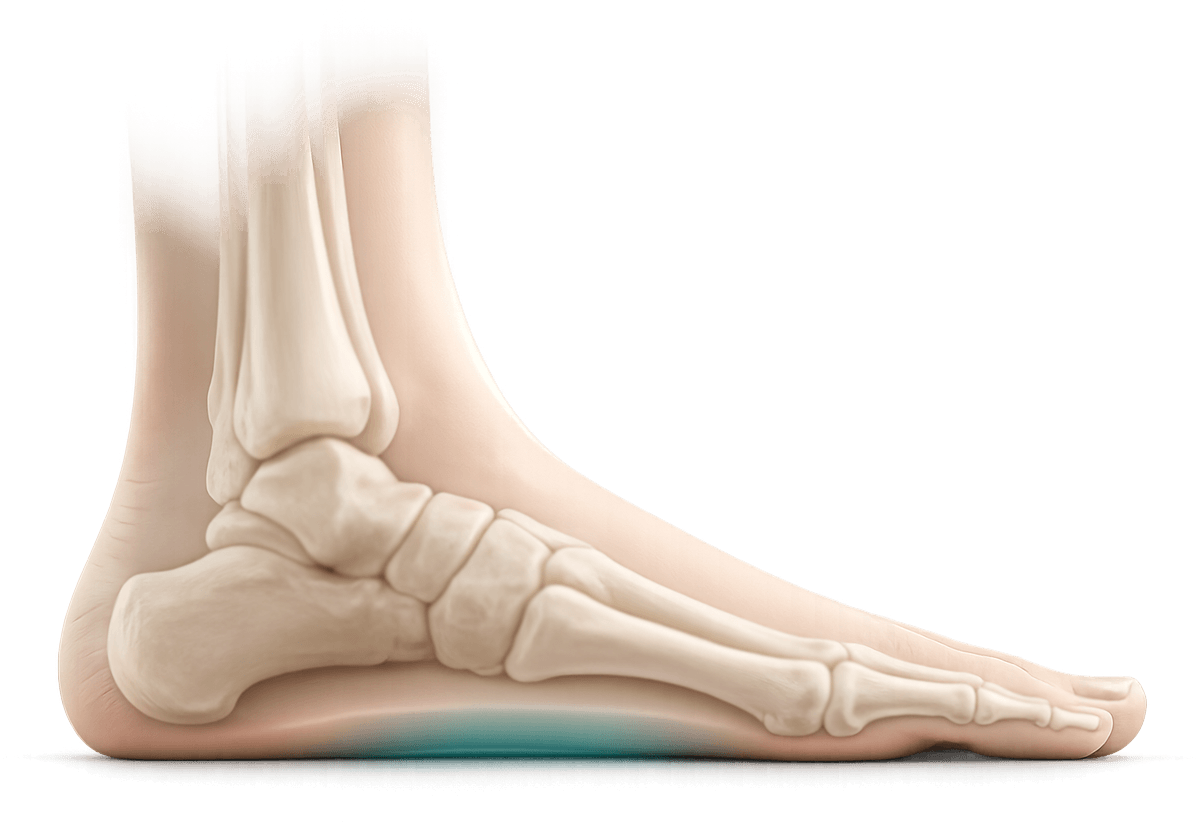 Flatfoot illustration